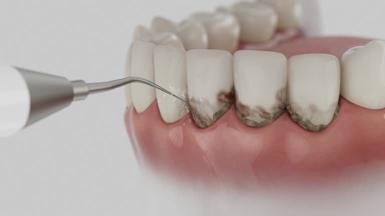 Trusted Tooth Extraction service in Lorton, VA - Dentist Open Now